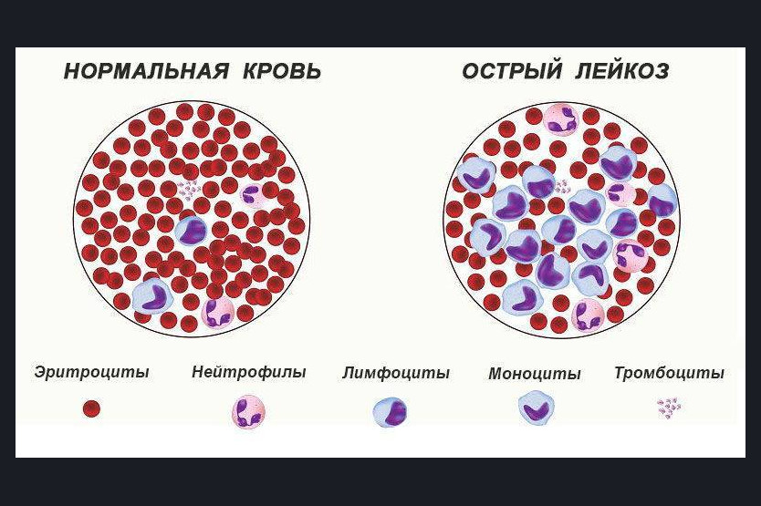 Лейкемия вирусная у кошек